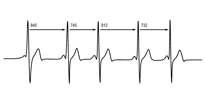 Polar Herzfrequenz-Variabilität RC3 GPS Sportuhr Bild über die Messung der Herzfrequenz-Variabilität, Zeitabstand zwischen zwei Herzschlägen